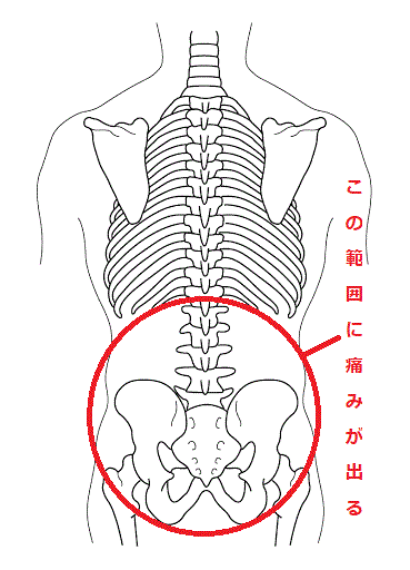 腰痛の定義